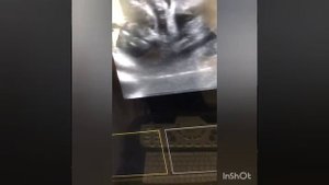 УЗИ беременной кошечки.mp4