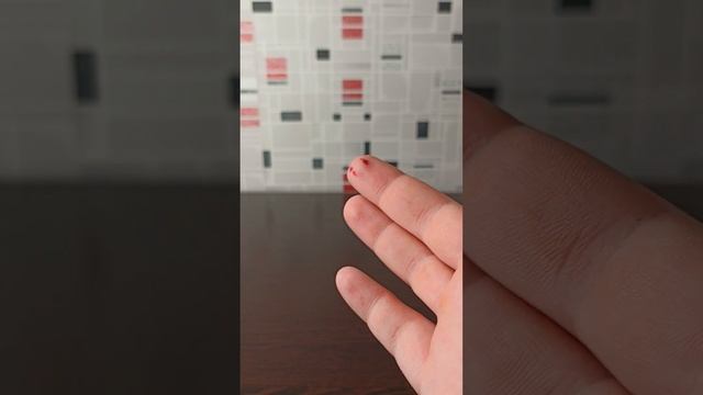 Как избавиться от укуса квокки. Последствия укуса смотреть онлайн