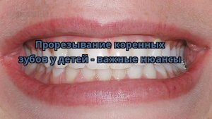 Прорезывание коренных зубов у детей - важные нюансы
