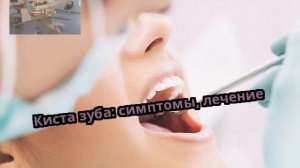 Киста зуба: симптомы, лечение