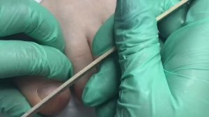 ОБРАБОТКА СТОП И ПАЛЬЧИКОВ / пенный размягчитель / как сделать педикюр