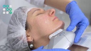 SMAS -лифтинг лица ULTRAFORMER (Ультраформер) Сеть клиник косметологии GEN87