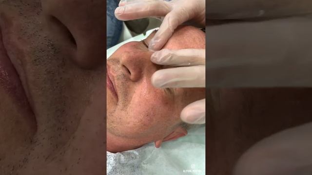 Процедура ПИЛИНГ LACTOBIONIC GREEN alpika_rostov_ Альпика Ростов-на-Дону Косметика alpika смотреть онлайн