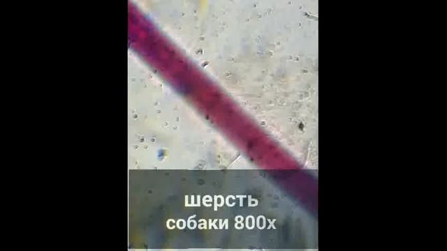 Топ 5 микроприпаратов смотреть онлайн