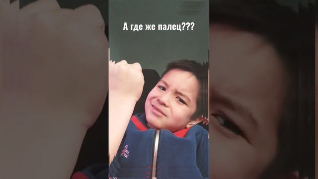 Что мне делать у меня .Отрезали мизимец