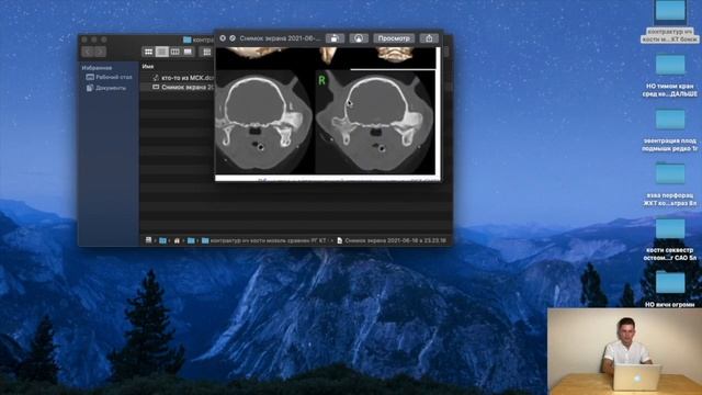 Котята подмышкой, тимома → мегаэзофагус → аспирационная пневмония, калибратор и сумки VetRg+ смотреть онлайн