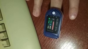 Не работает пульсоксиметр
