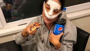 Рино-септопластика - До/после как все выглядит на самом деле