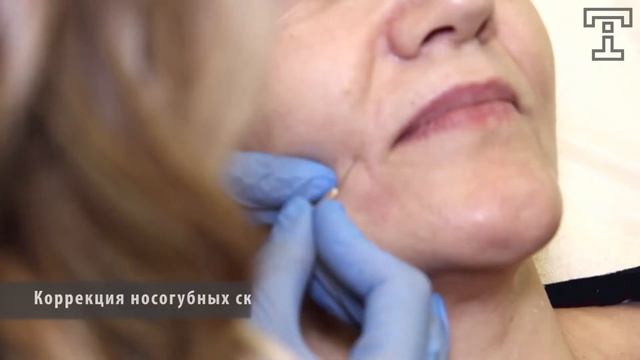 Клиника TORI. Коррекция носогубных складок