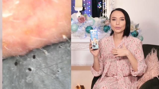 Маски пленки от черных точек под МИКРОСКОПОМ / Тестируем популярные маски Elizavecca Bioaqua Желати смотреть онлайн