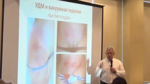 Максимов Георгий "Ударно-динамическое воздействие и вакумная терапия"