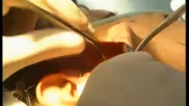 Фейслифтинг. Гогибиридзе О.Т. смотреть онлайн