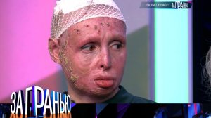 «За гранью»: «Распял и сжег!» | Выпуск от 22 января 2024 года