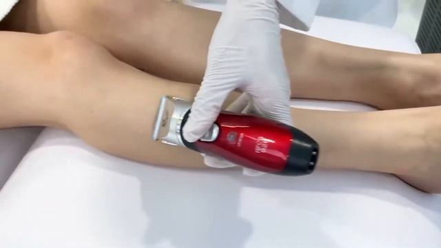 Диодный лазер Soprano Titanium | Как выбрать лазер для эпиляции смотреть онлайн