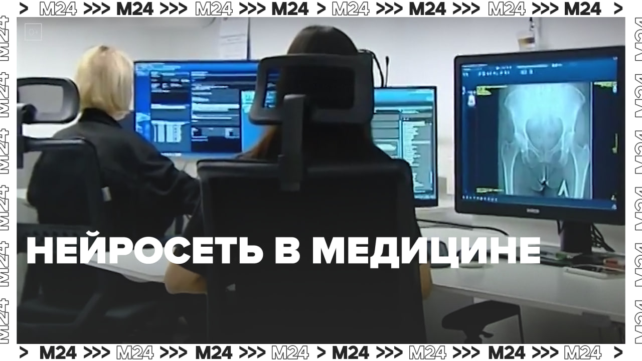 Нейросеть в медицине — Москва24 | Контент