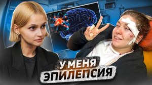 «Упала лицом на асфальт, ничего не помню» | Эпилепсия: приступы, лечение