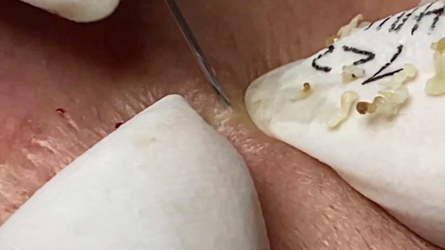 Enjoy Your Day With Hien Nguyen Spa # 1700 смотреть онлайн