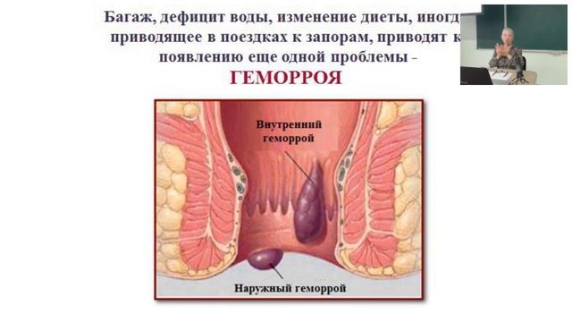 Летний отдых без проблем со здоровьем - лекция Н.Г Байкуловой смотреть онлайн
