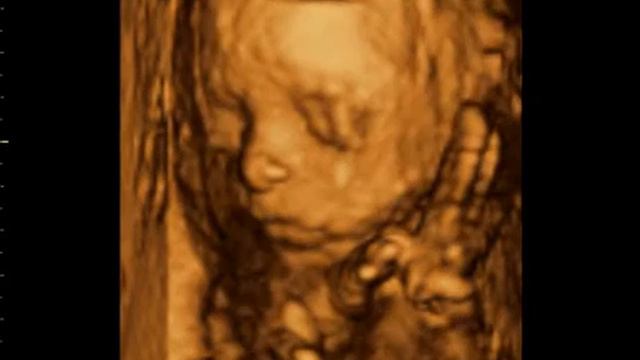 УЗИ 3D: Младенец в утробе матери смотреть онлайн