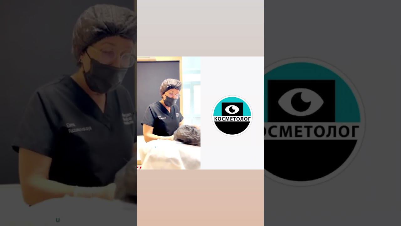 Как помочь коже при удалении филлера? #якосметолог #врачкосметолог #beauty смотреть онлайн