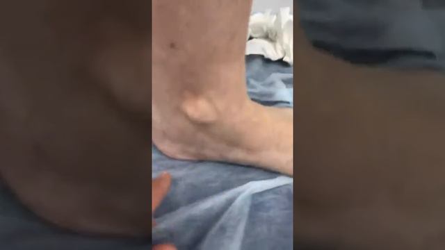 Осмотр флеболога Сардара Алиханова. Флеболог. Москва.