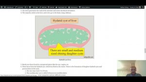 Echinococcus Granulosus, Hydatid cyst by labpedia.net Prof. Riaz A. Bhutta (Urdu, Hindi)