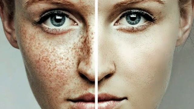 Пигментные пятна !Эффективная отбеливающая маска для лица в домашних условиях! смотреть онлайн