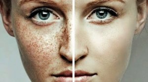 Пигментные пятна !Эффективная отбеливающая маска  для лица  в домашних условиях!