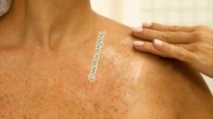 ➤ Сода и касторовое масло ➤ Целебное свойство ➤ От тысячи Болезней