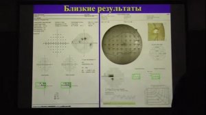 Особенности диагностики глаукомы на периметре COMPASS