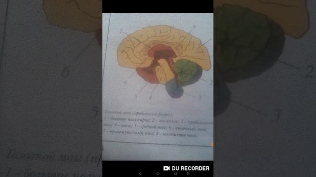 Программа для лечения ДЦП ,работа мозжечка и головного мозга.
