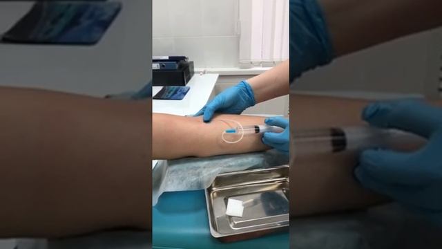 Традиционный забор крови из вены для анализов
