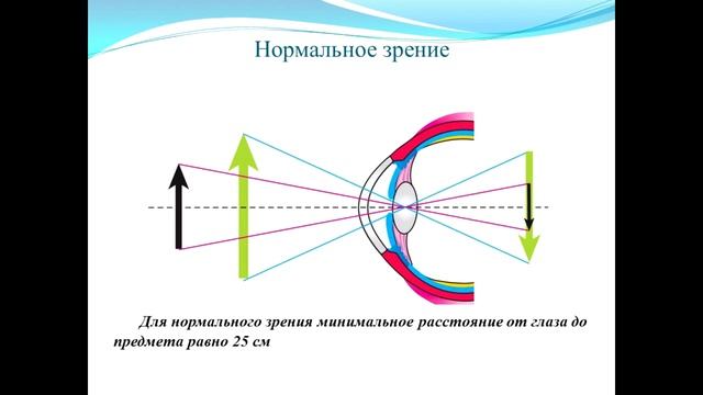 Тема 31. Глаз как оптическая система. Дефекты зрения. Очки смотреть онлайн