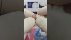 Нейлоновый протез