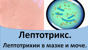 Лептотрикс. Лептотрихии.