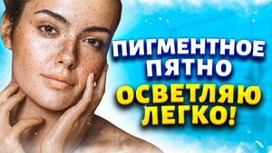 От пигментных пятен не осталось и следа. Покажу две хитрости, которые работают на 100%