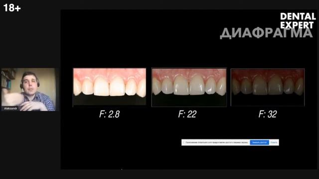 Основы дентальной фотографии Как стоматологу настроить камеру  под портретную и внутриротовую съемк