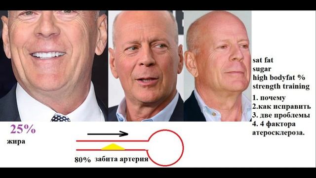 Брюс Виллис проблемы с мозгом, причины и что делать. смотреть онлайн