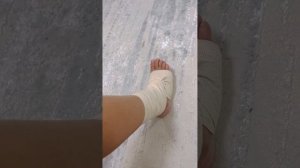 перелом лодыжки, сняли гипс на 30 день