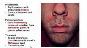 USMLE RX - 8.Анатомия - 2.Дерматология - 9.Себорейный дерматит