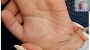 Дети аутисты. Практический курс по ведической хиромантии. Урок 4.