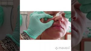 Один из лучших липолитиков для лица/сжигатель жировых отложений/