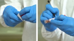 Методика забора клинического материала для диагностики коронавирусной инфекции COVID-19
