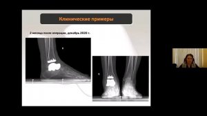 Лекция Карлова А.В.  Инновационные технологии керамического эндопротезирования 10 февраля 2021