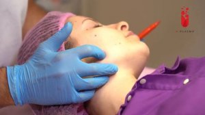 Как провести PRP терапию по лифтинг точкам | Бьютификация лица по реперным точкам| fullface