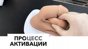 Фаллопротезирование. Принцип работы трёхкомпонентного имплантата. Titan touch (Coloplast)