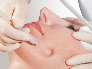 Процедура газожидкостный пилинг