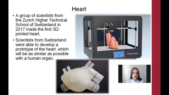 3D modeling in surgery