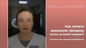 Как лечить анальную трещину после лучевой терапии?