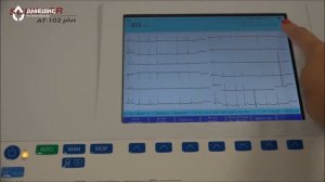 ЭЛЕКТРОКАРДИОГРАФ SCHILLER CARDIOVIT AT-102 PLUS